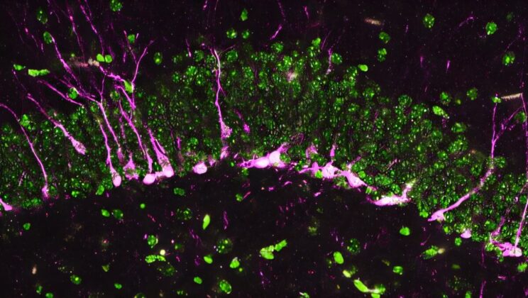 The Stench of Rotten Eggs Might Hold the Secret to Reversing Alzheimer’s Disease