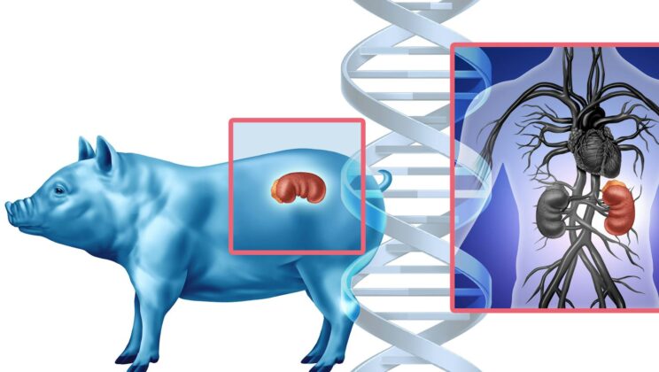 Xenotransplantation: How Technology Is Making Pig Organs Safe for Humans