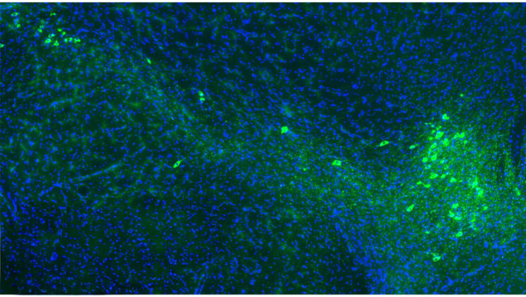 Scientists Finally Identify the Molecular Gates That Let Parkinson’s Spread Through the Brain