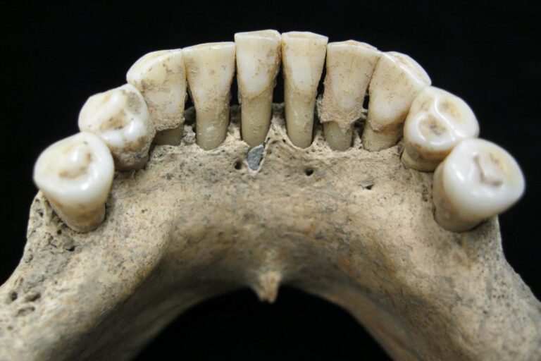 Teeth Nes 10 Things Your Teeth Reveal to Archaeologists