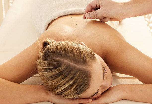 Your Brain Connectivity Patterns Could Predict If Acupuncture Will Stop Your Migraines