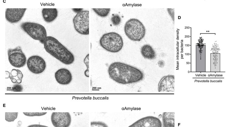 This Common Gut Sugar Might Be the Hidden Trigger for ALS and Dementia
