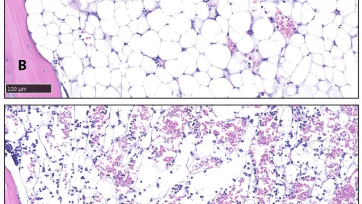 Scientists Found a Secret Brain Switch That Can Erase Body Fat Without Dieting