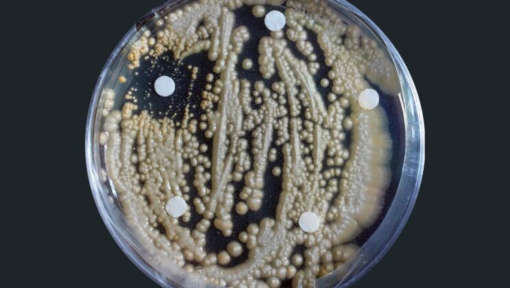 The Harmless Fungi in Your Garden May Be One Small Shift Away From Becoming Human Pathogens