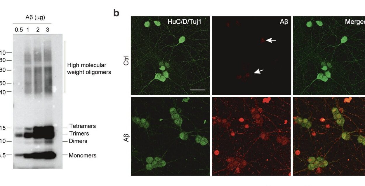 Alzheimers Disease Might Actually Start in Your Gut Years Before Memory Fades