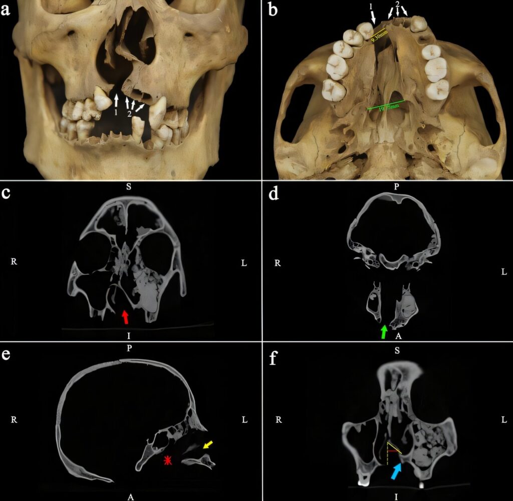 This 200 Year Old Skull Reveals a Secret History of Ancient Compassion