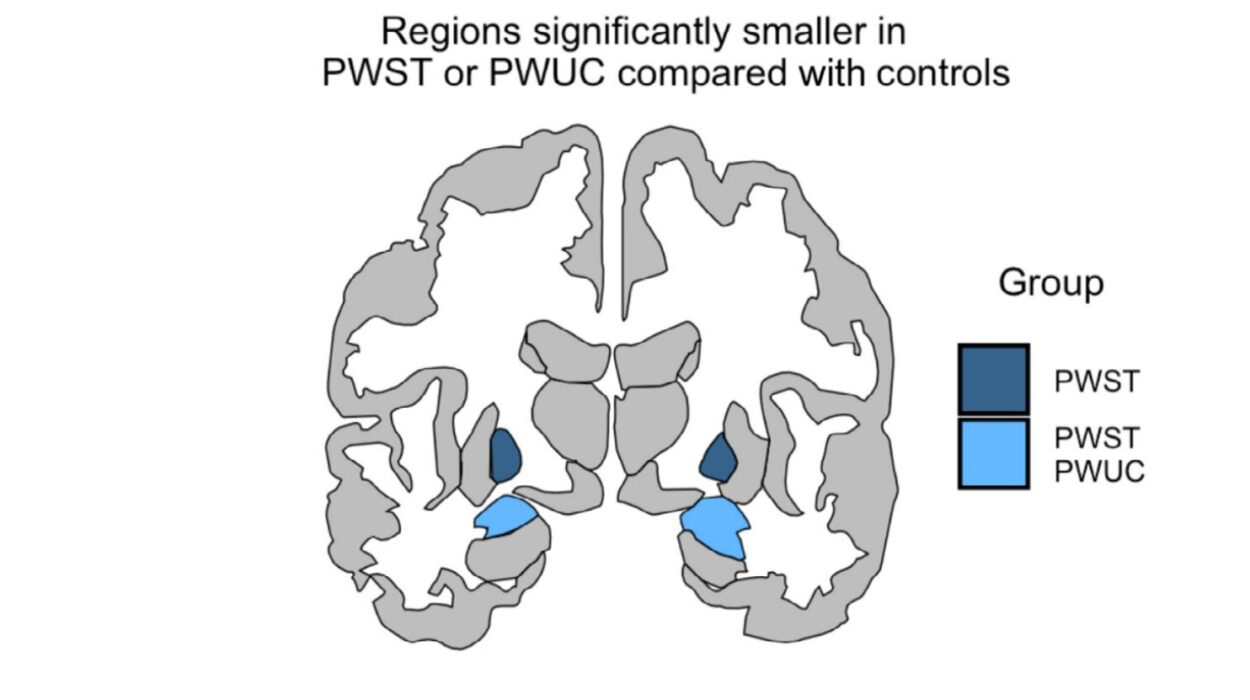 Your Brain on a Habit Is Actually Smaller Than You Think