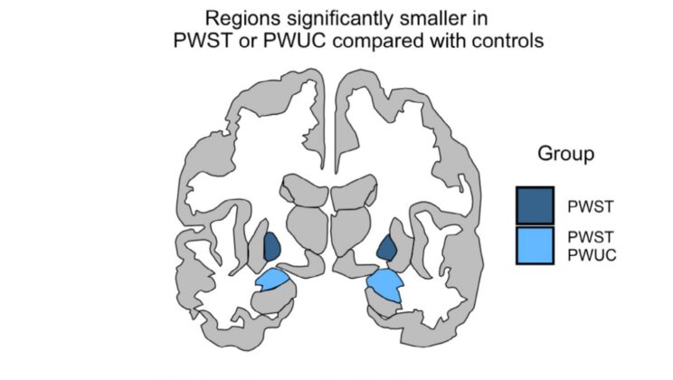 Your Brain on a Habit Is Actually Smaller Than You Think