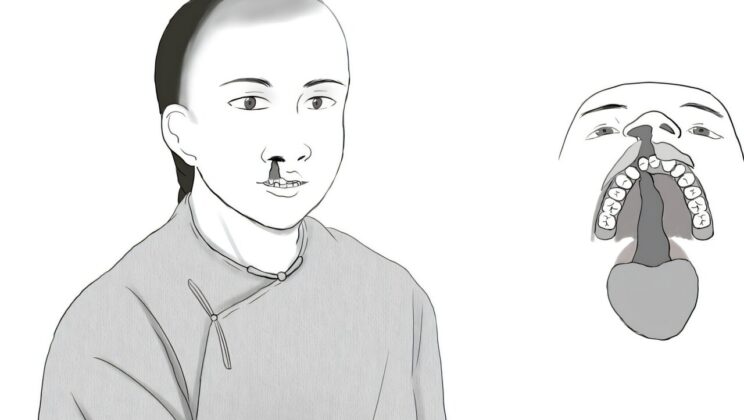 This 200 Year Old Skull Reveals a Secret History of Ancient Compassion