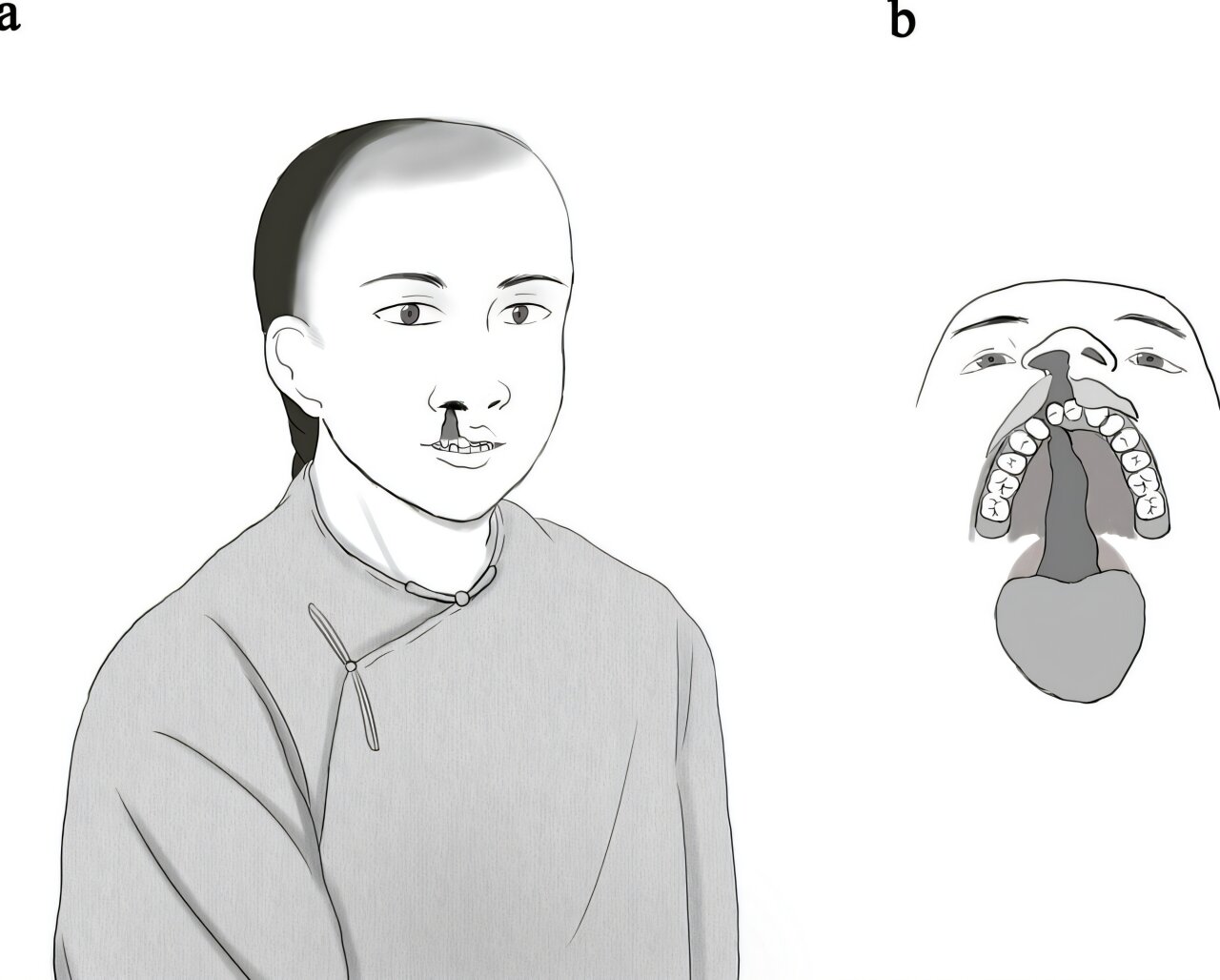 This 200 Year Old Skull Reveals a Secret History of Ancient Compassion