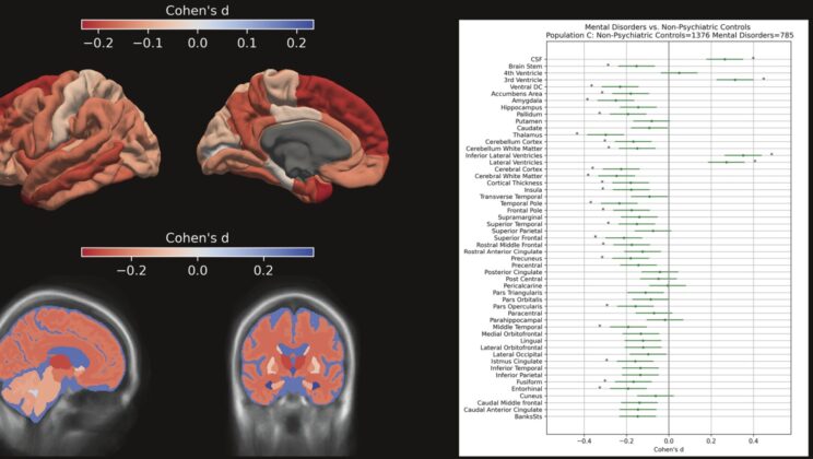 Your Last Routine Hospital Brain Scan Might Hold the Secret to Your Mental Health