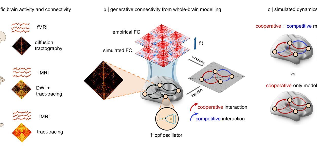 Scientists Discover That Thoughts Actually Fight Each Other for Space in Your Mind