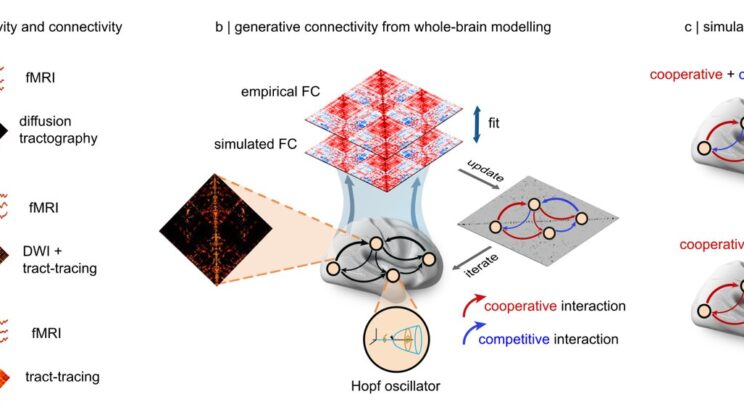 Scientists Discover That Thoughts Actually Fight Each Other for Space in Your Mind