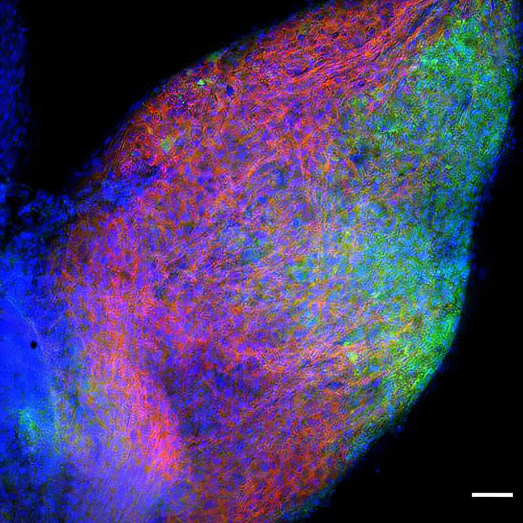 Neurons Dont Always Take the Direct RouteScientists Discover a Hidden Protein Detour System Inside Brain Cells