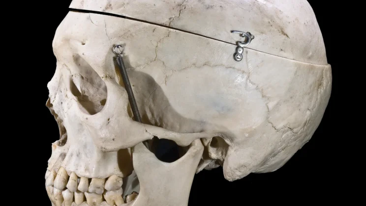 Why Do Humans Have Chins? Evolution Still Can’t Fully Explain It