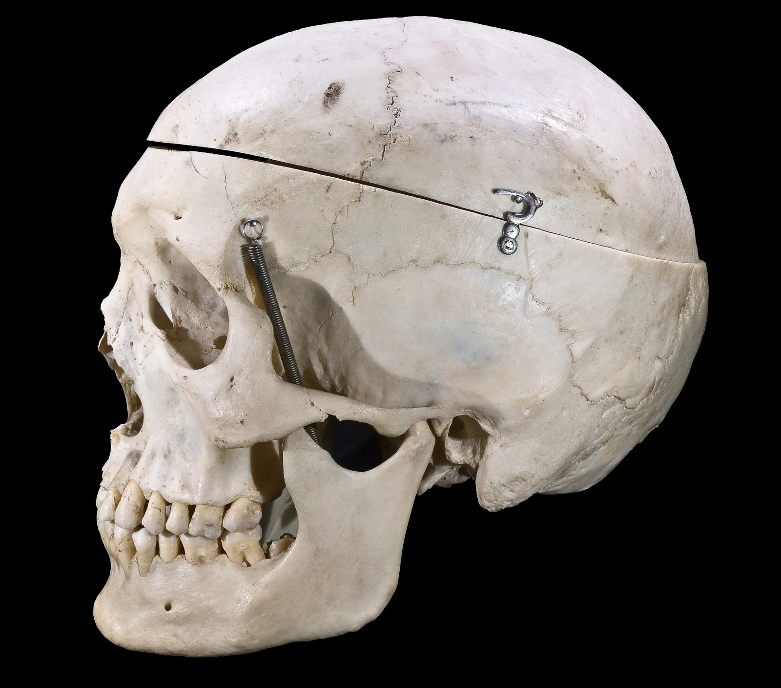 Why Do Humans Have Chins? Evolution Still Cant Fully Explain It