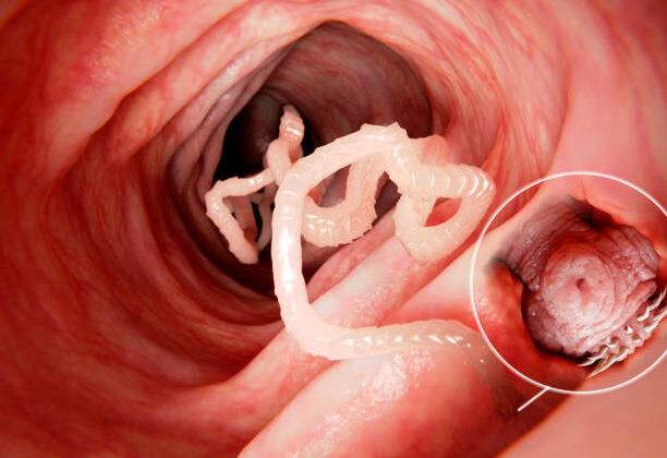 The Most Terrifying Parasites That Can Live Inside Humans