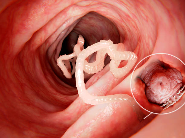 The Most Terrifying Parasites That Can Live Inside Humans