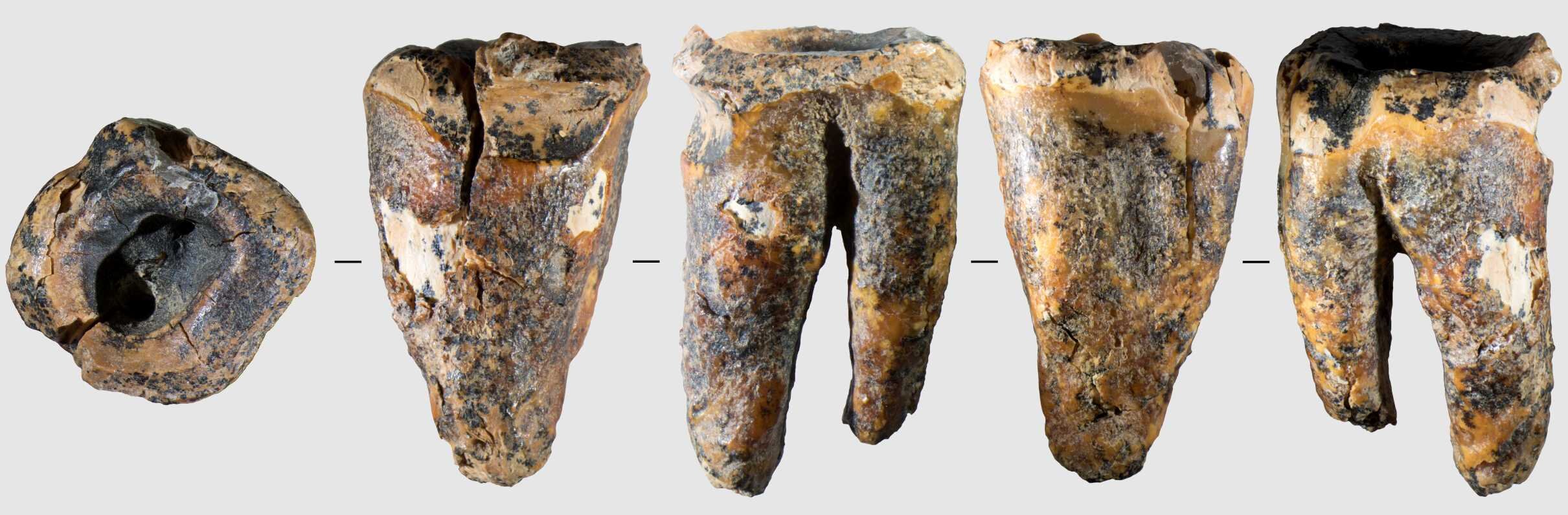 Neanderthals May Have Practiced Dentistry 59,000 Years Ago, Fossil Tooth Suggests