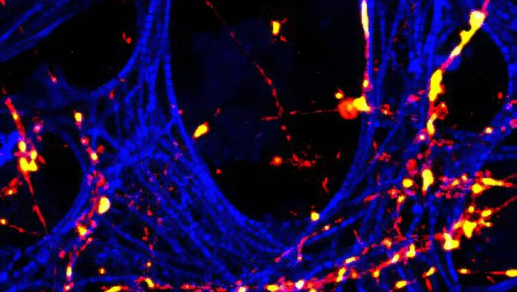Neurons Don’t Always Take the Direct Route—Scientists Discover a Hidden Protein “Detour” System Inside Brain Cells