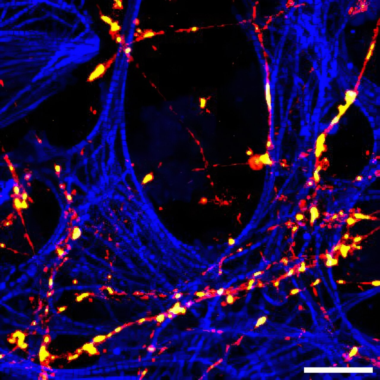 Neurons Dont Always Take the Direct RouteScientists Discover a Hidden Protein Detour System Inside Brain Cells