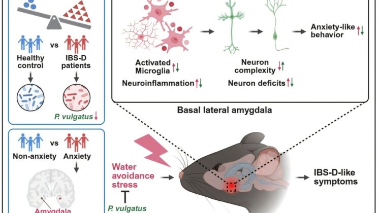 Gut Bacteria May Help Ease Anxiety in People With IBS by Reducing Brain Inflammation, Study Suggests