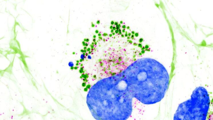Scientists Solved a 60-Year Collagen Mystery—and It Could Change How We Think About Fibrosis and Cancer