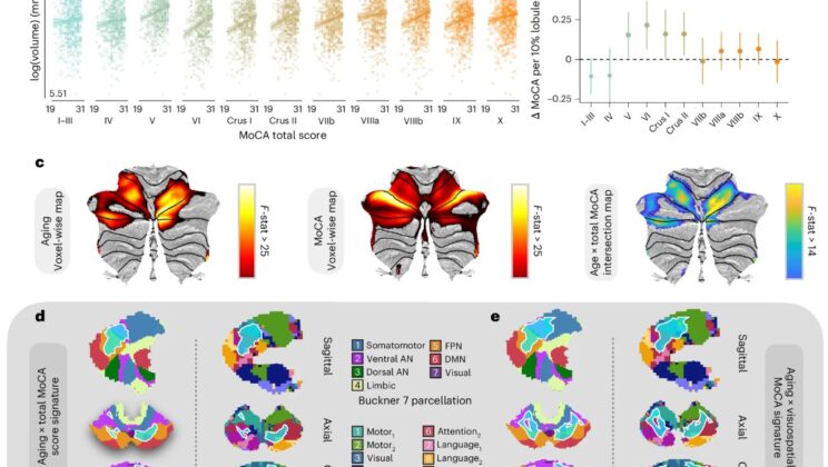 Scientists Discover the Cerebellum May Help Keep Your Memory Sharp as You Age and Larger Cerebellums Are Linked to Better Thinking Skills