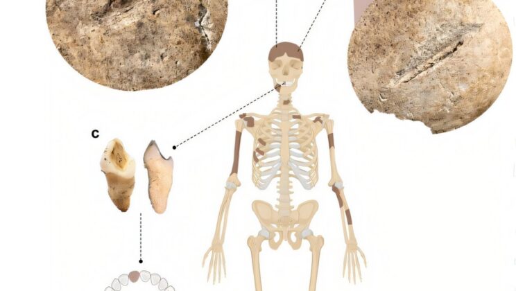 Langobard Woman Survived Brutal Head Injuries 1,400 Years Ago, Challenging Assumptions About Violence in Early Medieval Society
