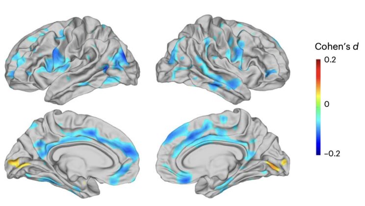 Massive MRI Analysis of More Than 12,000 People Reveals Brain Structure Changes Linked to Depression That Differ by Age and Treatment Stage