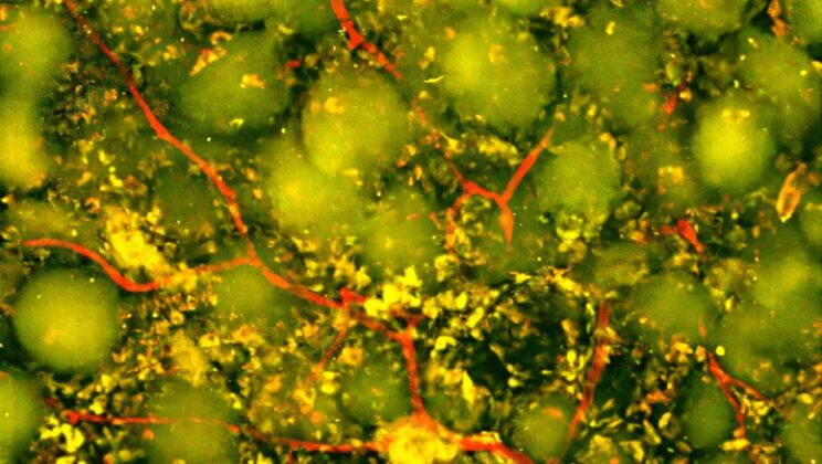 Injectable Hydrogel Carrying IL-4-Activated Astrocyte Vesicles Helped Mice Regrow Blood Vessels in Stroke-Damaged Brain Tissue and Regain Near-Normal Movement