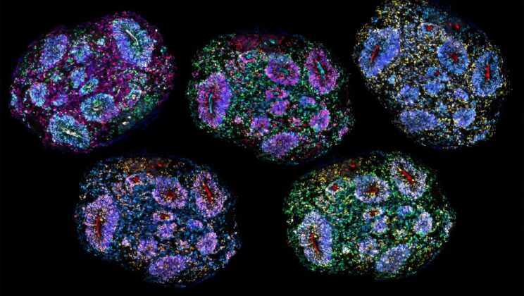 Lab-grown brain cells kept maturing for seven years and retained their developmental history