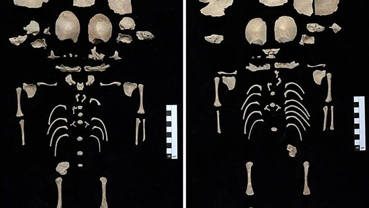 Archaeologists Uncovered Two Possible Premature Twins Sealed Inside an Abandoned Roman Latrine for More Than 1,100 Years