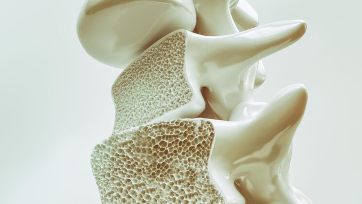 The brain’s wiring aged faster in older adults with lower spinal bone density